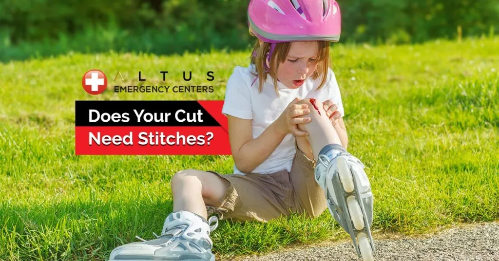 child on skates with a knee cut