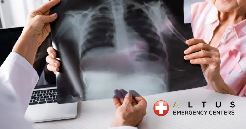 Warning Signs You Need to Get a Chest XRAY, EKG, or CT