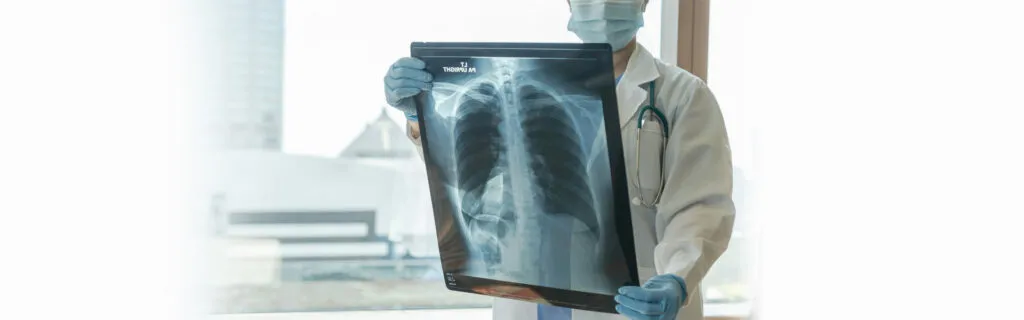 doctor reviewing a chest x-ray
