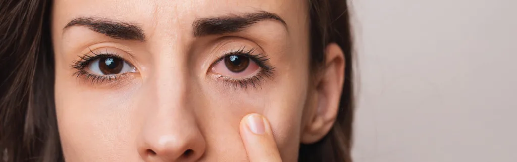 woman with pink eye