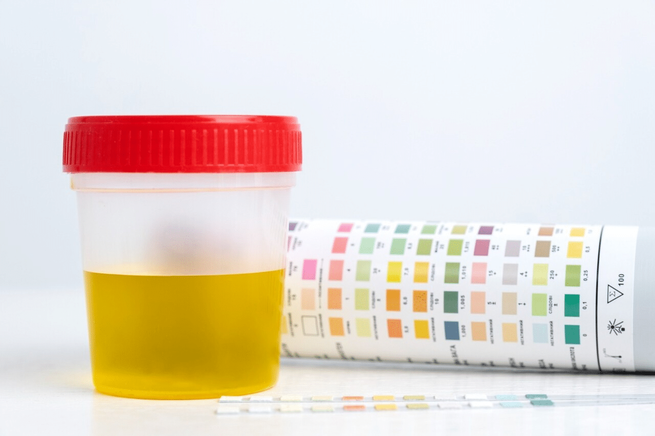 Can a Urine Drug Test Show How Much You Take?