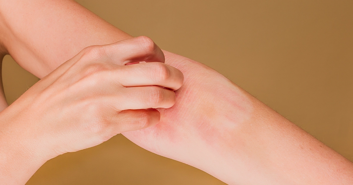 What Causes Itching That Moves Around The Body