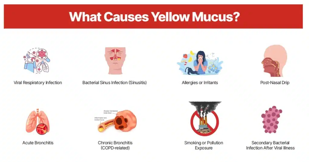 Infographic showing common causes of yellow mucus.