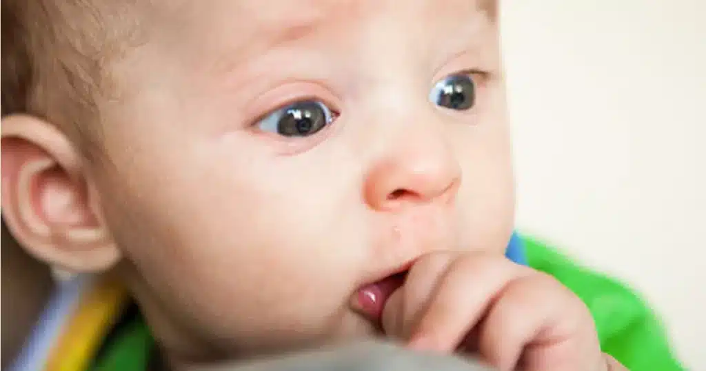 Baby sucking thumb, possibly showing teething symptoms and runny nose.