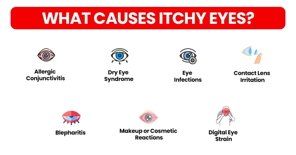 Infographic showing common causes of itchy eyes.