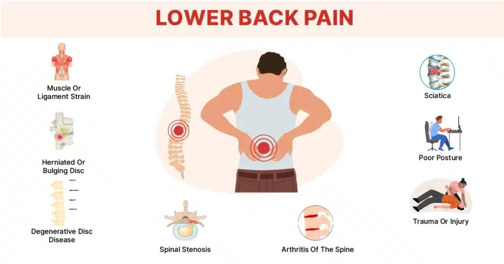 Infographic showing common causes of lower back pain.