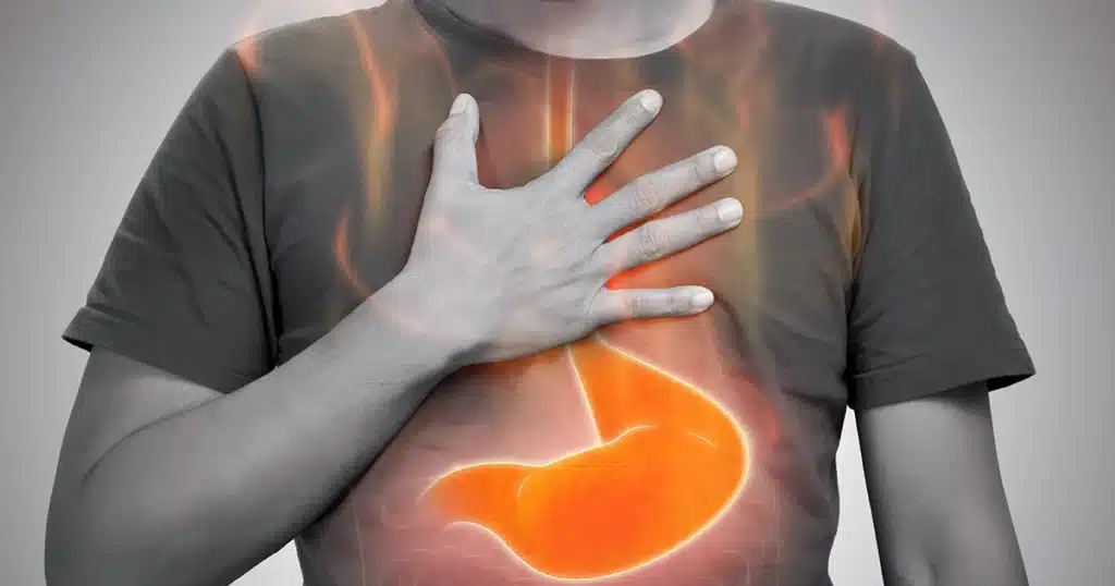 Person holding chest with glowing stomach showing acid reflux pain.