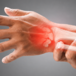 X-ray view of a painful wrist injury with red swelling highlighted.