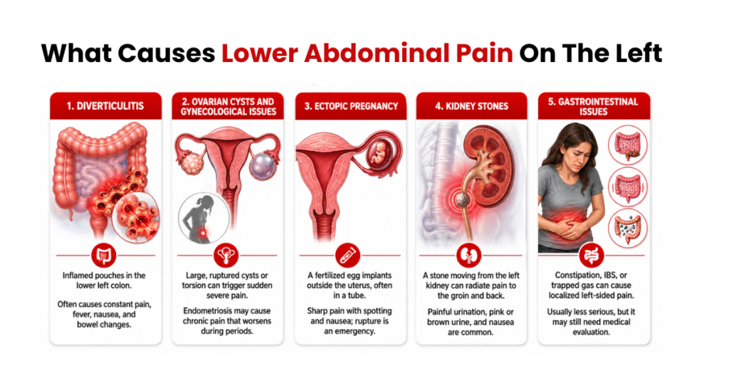 Infographic showing causes of lower left abdominal pain.