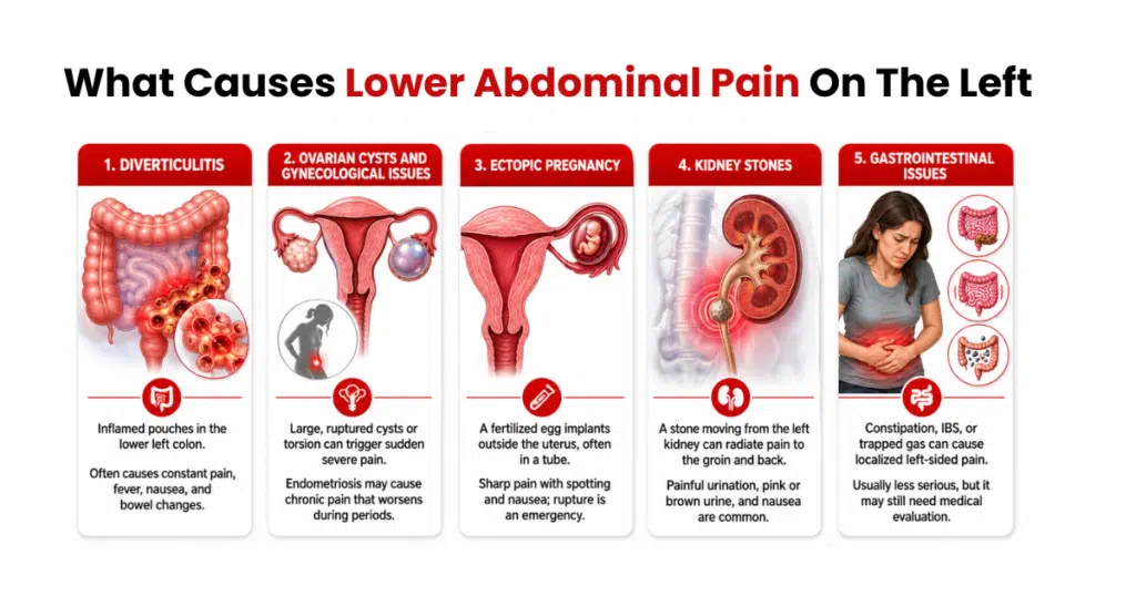 Infographic showing causes of lower left abdominal pain.