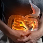 Woman holding stomach experiencing severe diarrhea.