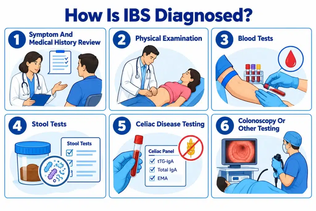 Infographic showing six steps for diagnosing irritable bowel syndrome.