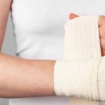 Person holding bandaged Colles fracture wrist